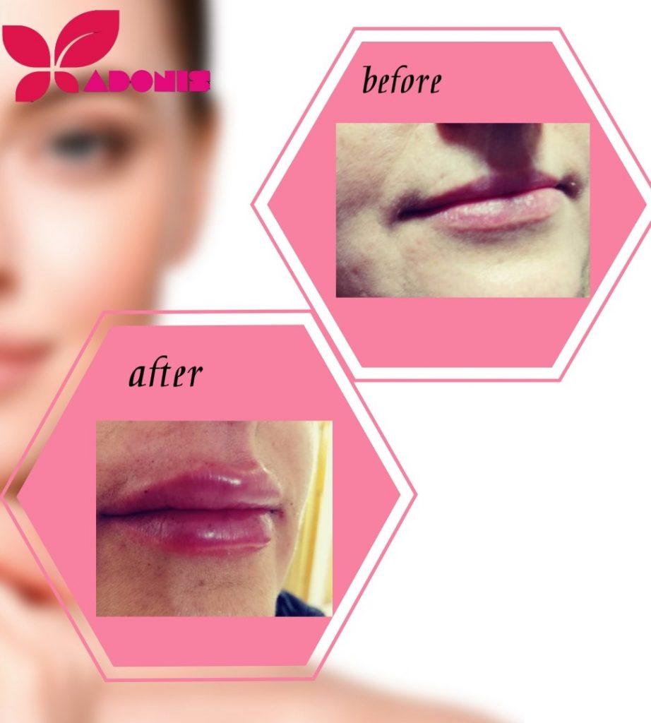 کلینیک زیبایی پوست و مو و لیزر آدونیس در لاهیجان کلینیک زیبایی پوست و مو و لیزر آدونیس در لاهیجان